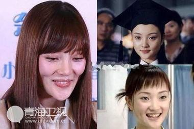 整容撞脸的明星,揭秘网红与明星的惊人相似度