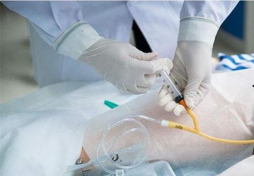护士给病人插尿管视频,直观展示插尿管全过程